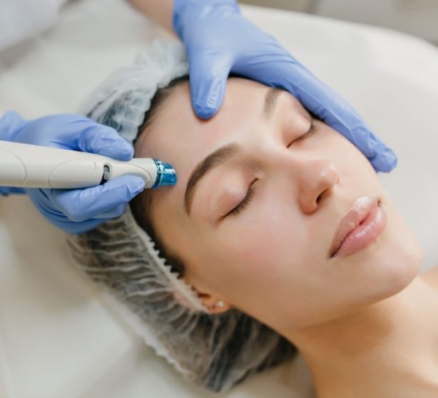 Rozjasnění a regenerace pleti microneedlingem image